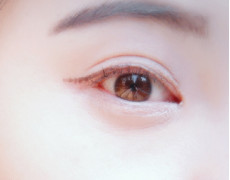 適合選擇做開眼角手術的人群